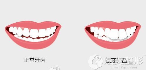 ɶT͹Ҫݹ̓r͵ȫȅ^e